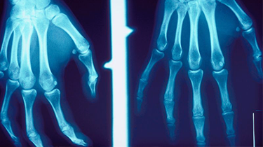 hand and wrist surgery.png hand and wrist surgery